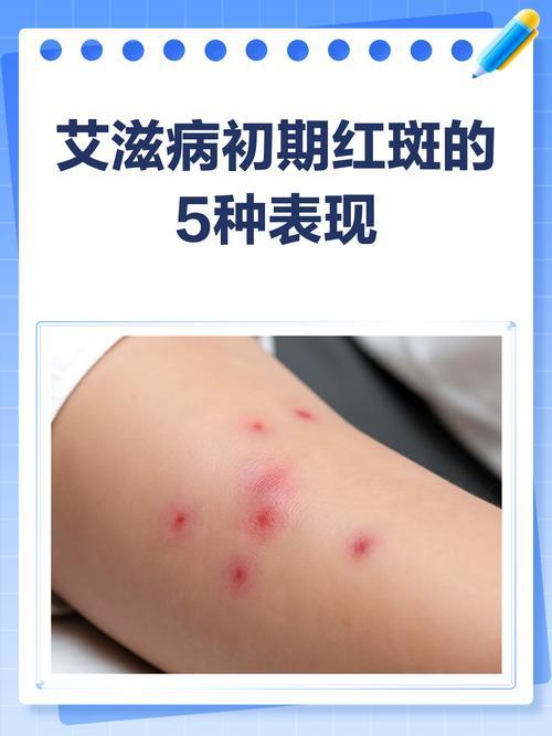 69岁村医确诊艾滋，死也不愿说的秘密：几十元的交易，毁了一辈子体面
 
谁能想到