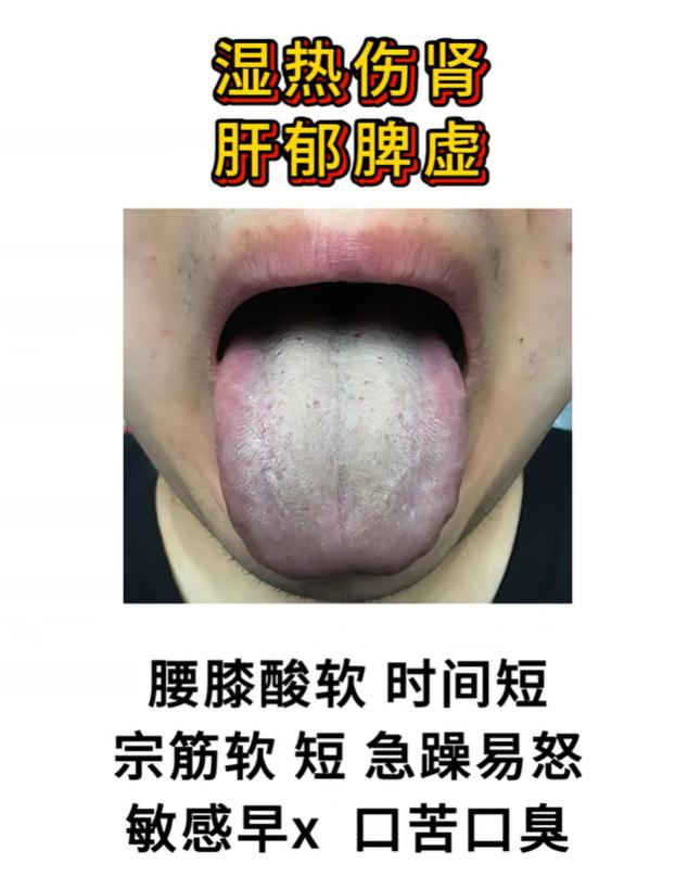 4 种男性常见舌象分析，看看你的体质属于哪一种？