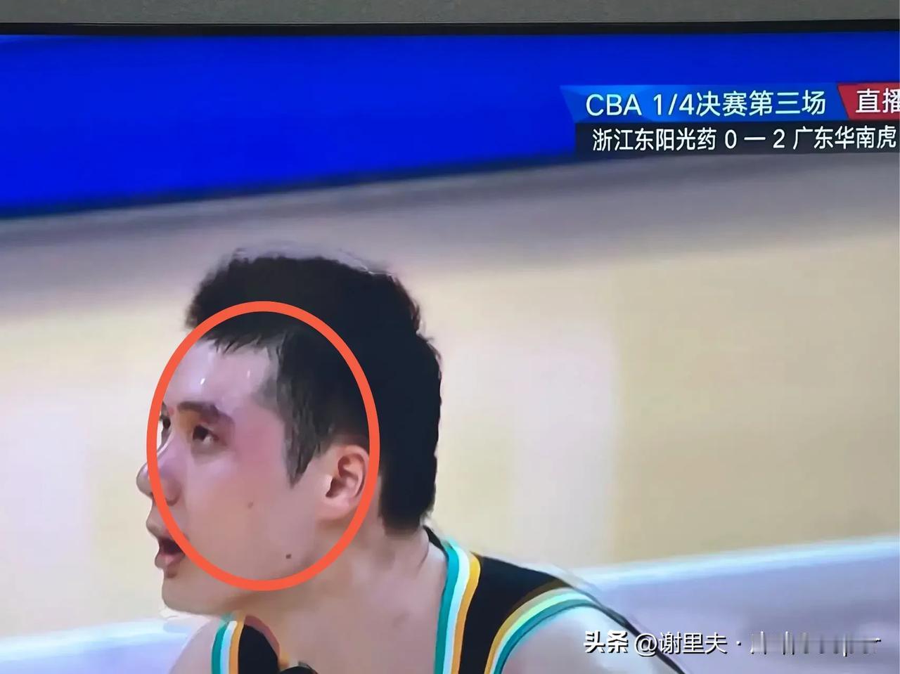 李金效挨周琦这下，罚篮时脸红肿，冥冥之中自有安排，莫兰德错过在半决赛对阵周琦的机