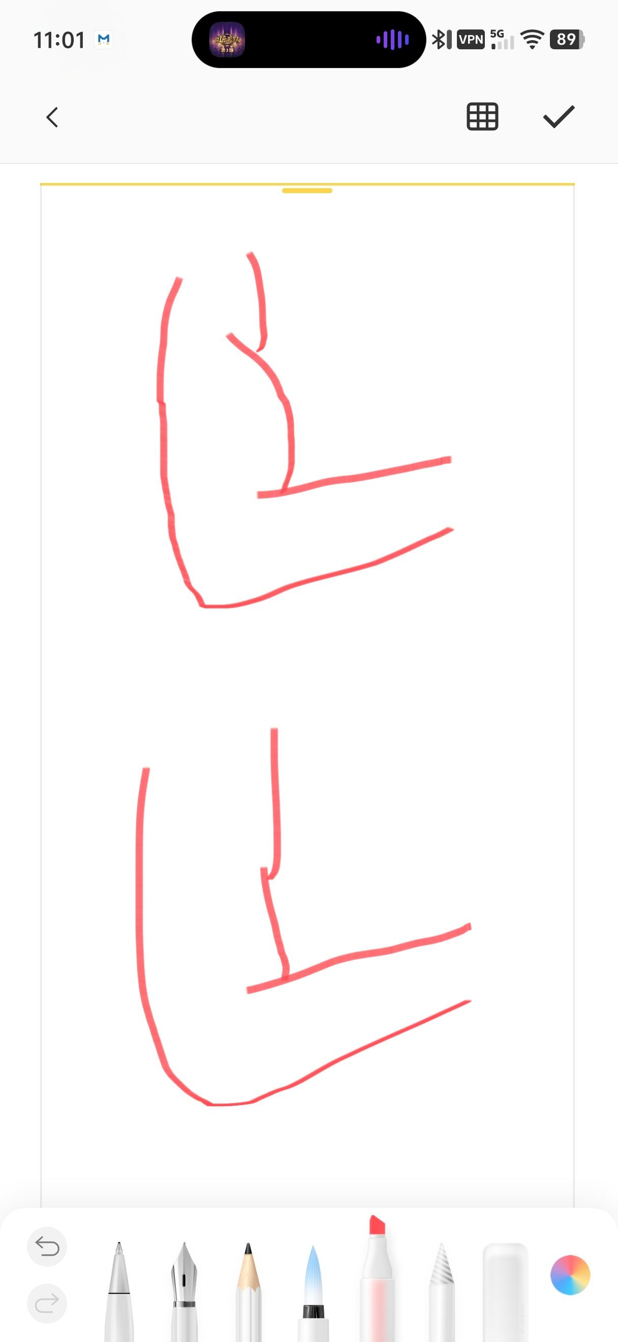 为什么别人的二头都是上面那样但我的二头是下面那样 