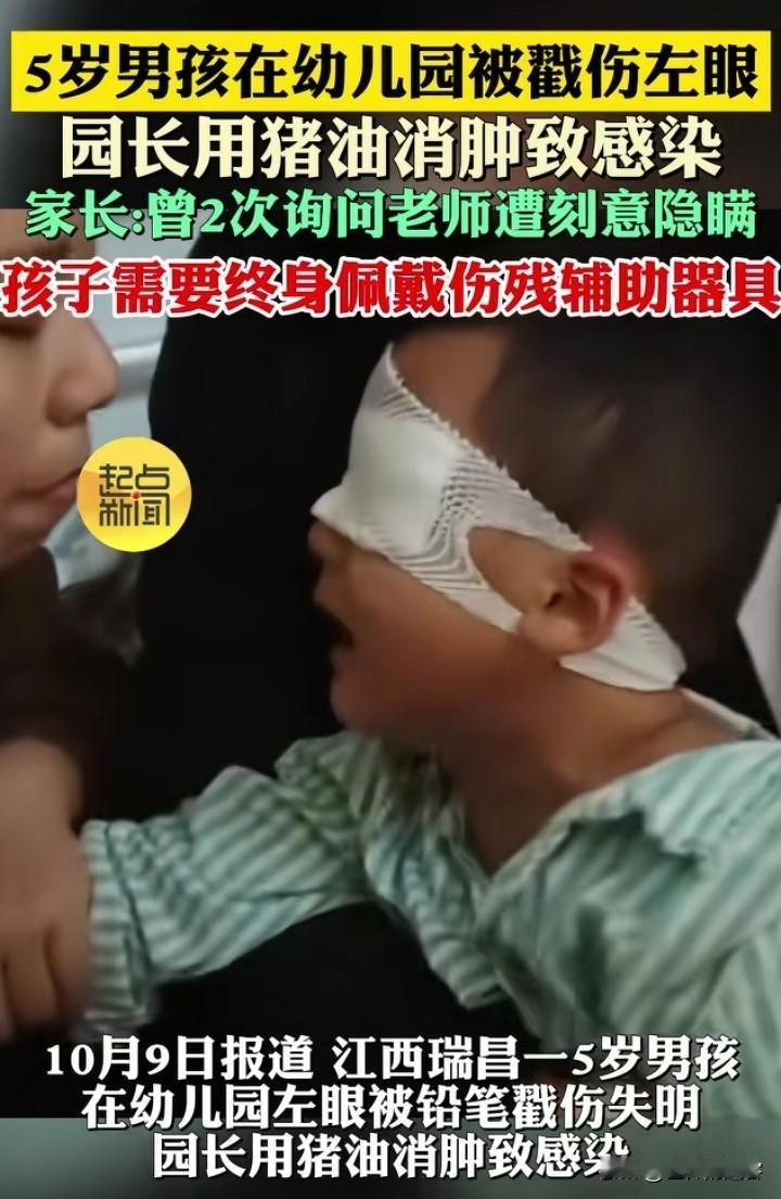 这老师配做老师吗？刻意隐瞒孩子在学校受伤，还用偏方导致孩子眼睛失明！

近期，一