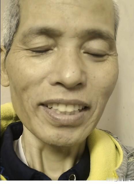 才四十八岁的他被癌症折磨成了这个样子。
刷到他的抖音时心里一紧，这是一个善良的男