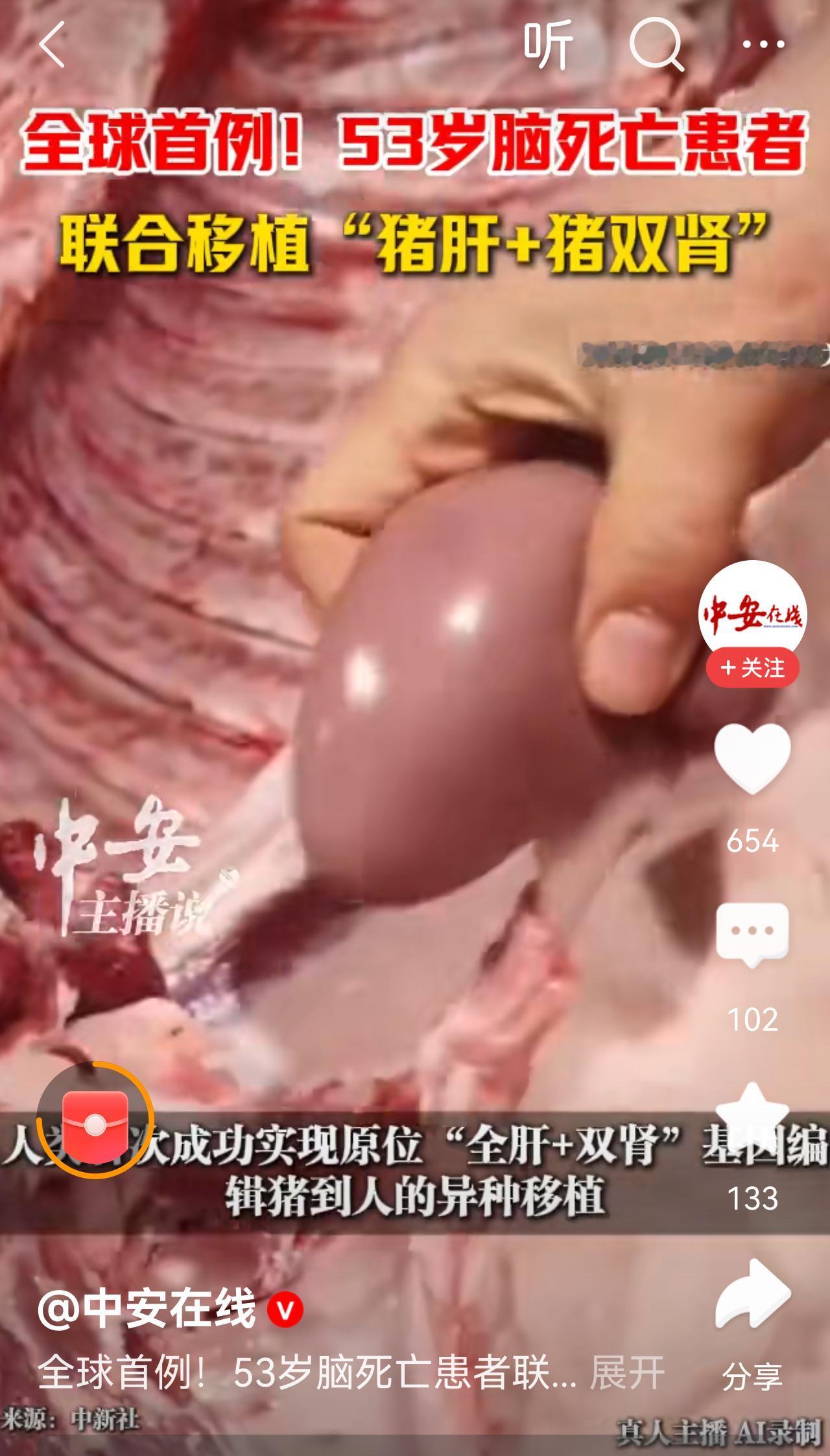 不懂就问
这位植物人换上猪肝，猪肾就能醒了?
家属凭啥替病人做主?