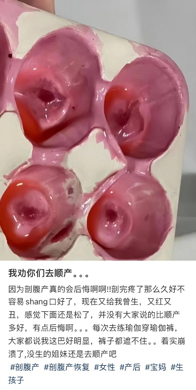 我劝你们去顺产。。。 ​​​