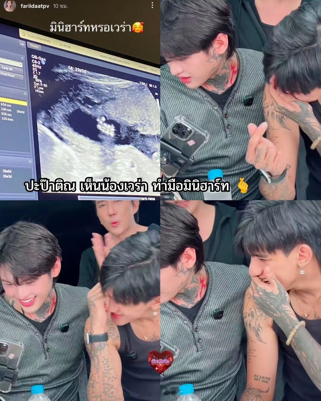 泰星tintin女儿比心 泰星Tintin看到女儿在超声波里比出的迷你心形手势，