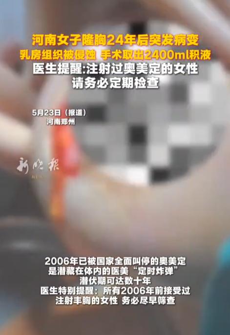 “担心的事还是发生了！”河南，52岁的李女士，乳房突然肿得跟篮球一样大，此后她反
