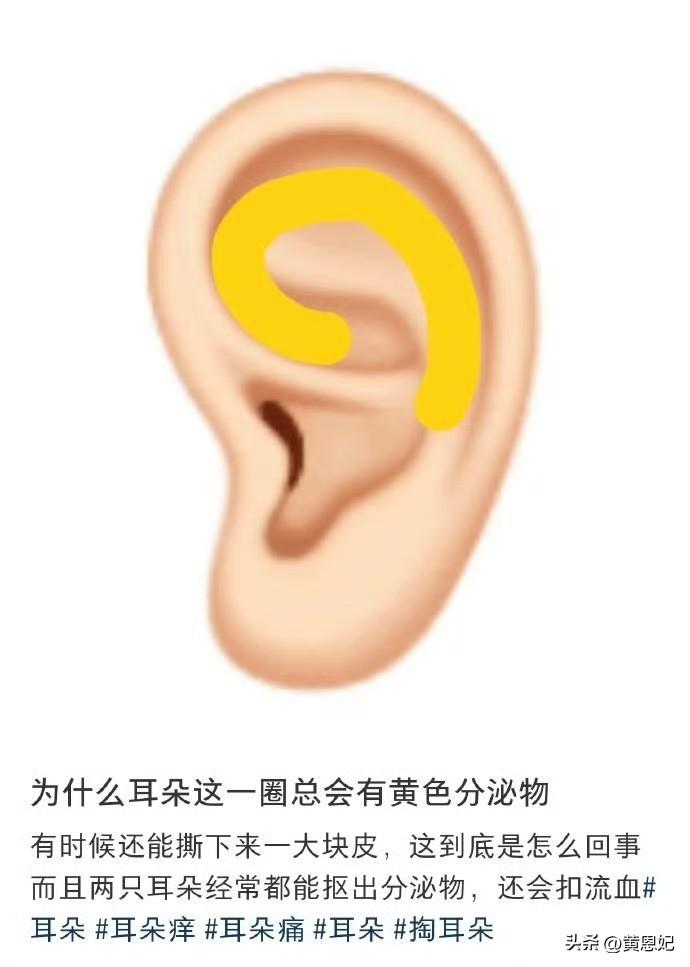终于有人科普了耳朵这一圈的黄色分泌物 ​