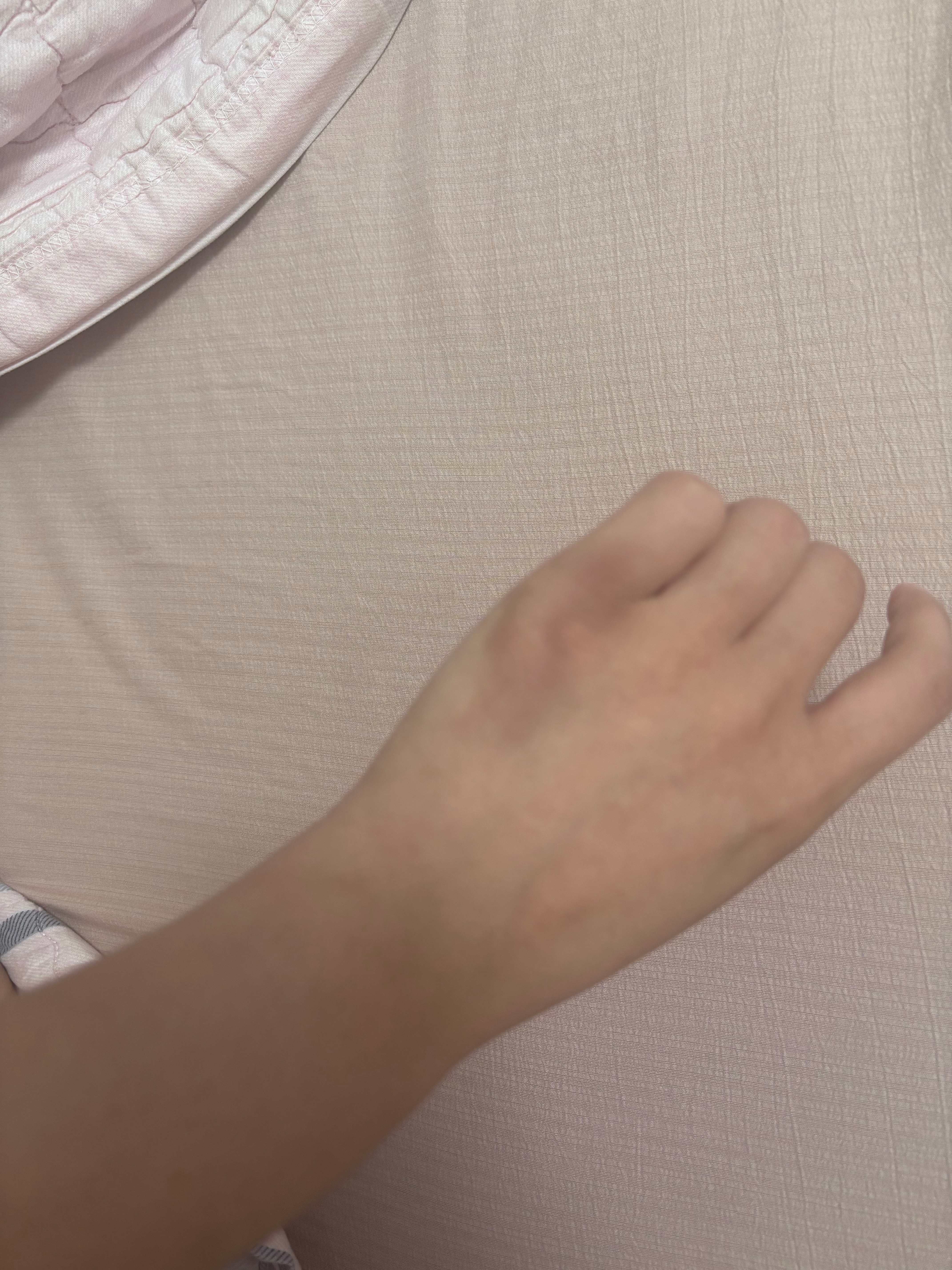 感统失调就这样，老是不小心磕磕碰碰ㅠㅠ 
