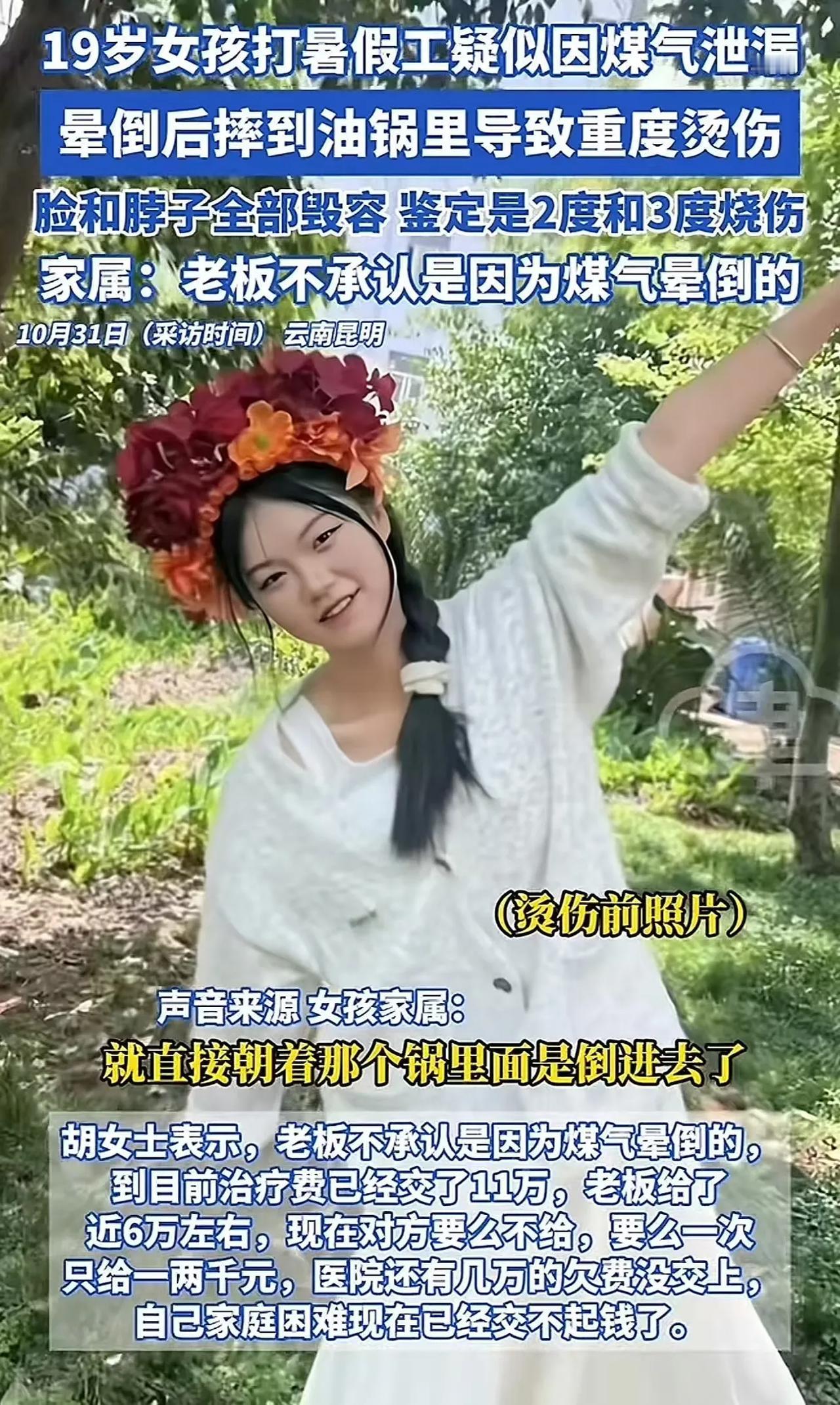 云南昆明，19 岁女孩打暑假工，疑似因煤气泄漏晕倒后摔到油锅里，导致脸和脖子全部