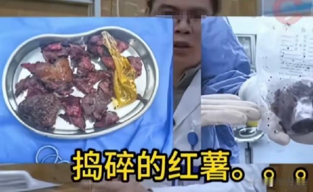 这大爷真是个奇葩！四川成都，一位61岁大爷半夜11点突发奇想，竟把一根长17厘米