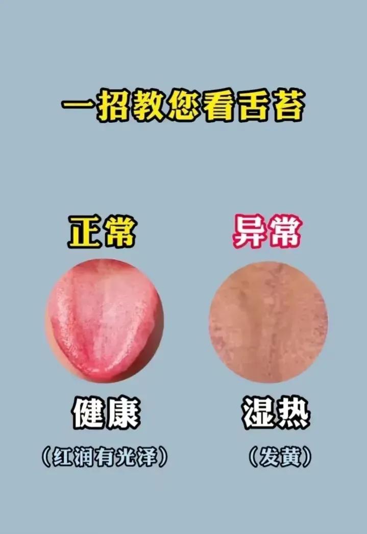 一招教你看舌苔，让你轻松掌握身体的健康密码！你是否经常感觉身体不适，但又不知道原