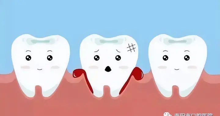 红薯|牙周病的形成和预防