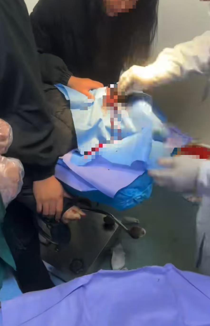 女子坐电瓶车摔倒，头被鲨鱼夹扎破，缝了9针：看过新闻，没想到发生在自己身上

1