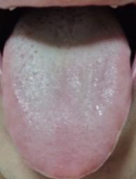 苓桂术甘汤 —— 专攻寒湿痰饮，清稀白痰一剂消！
大家好，我是中医陈大夫！
很多