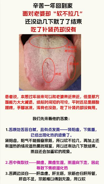 舌象分析