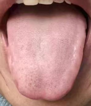 为何越补越没效果？多是体内有瘀堵，通络养气身体更稳健






很多中年朋友常