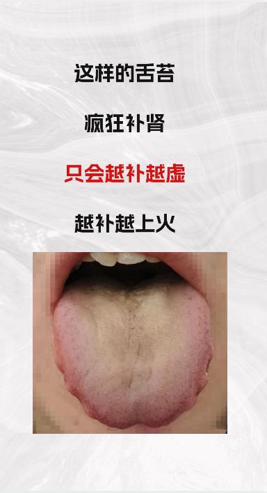 这样的舌苔，疯狂补肾 ，只会让你越补越虚，越补越上火
