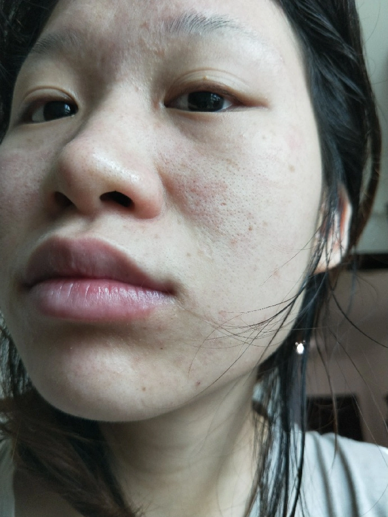 美容院辞职，说点得罪人的大实话（毛孔篇）