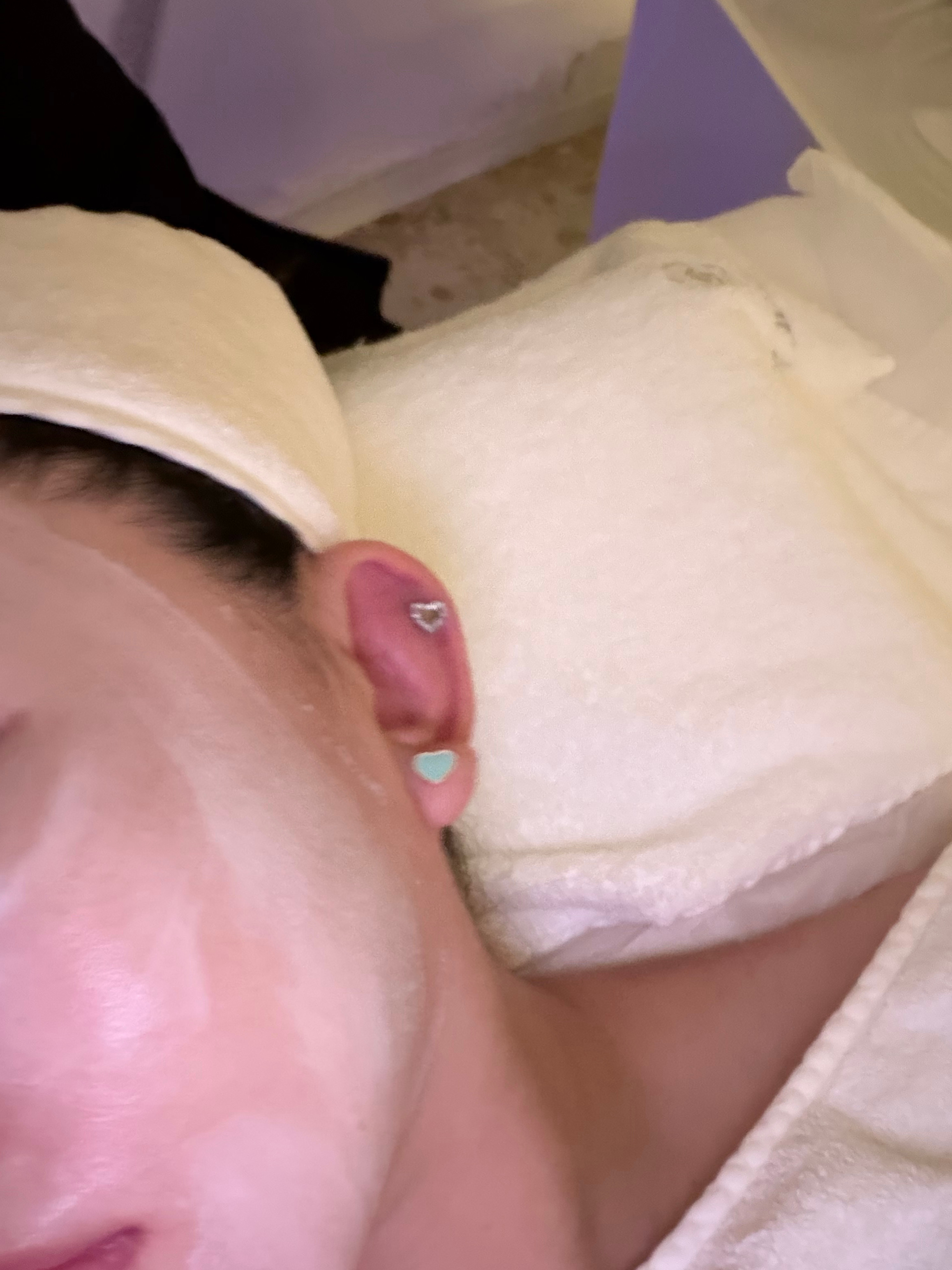 来重庆出差 顺便做了个面部眼部下颌线indiba 才680！比成都便宜了一倍多！