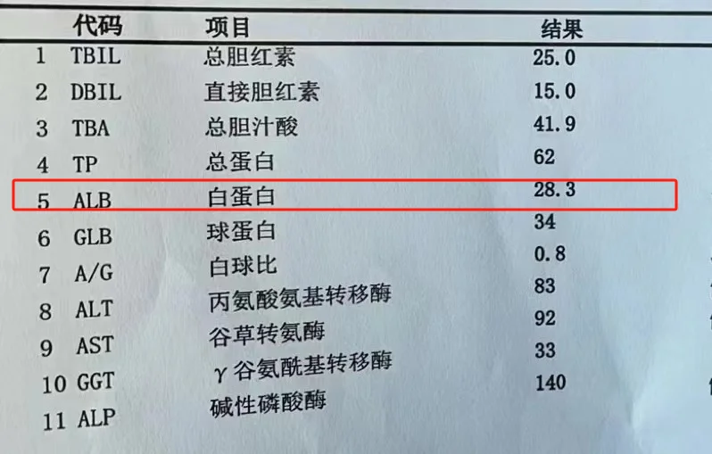 肝硬化患者注意！这一项指标异常，很可能出现腹水！ 肝功能大家应该都不陌...