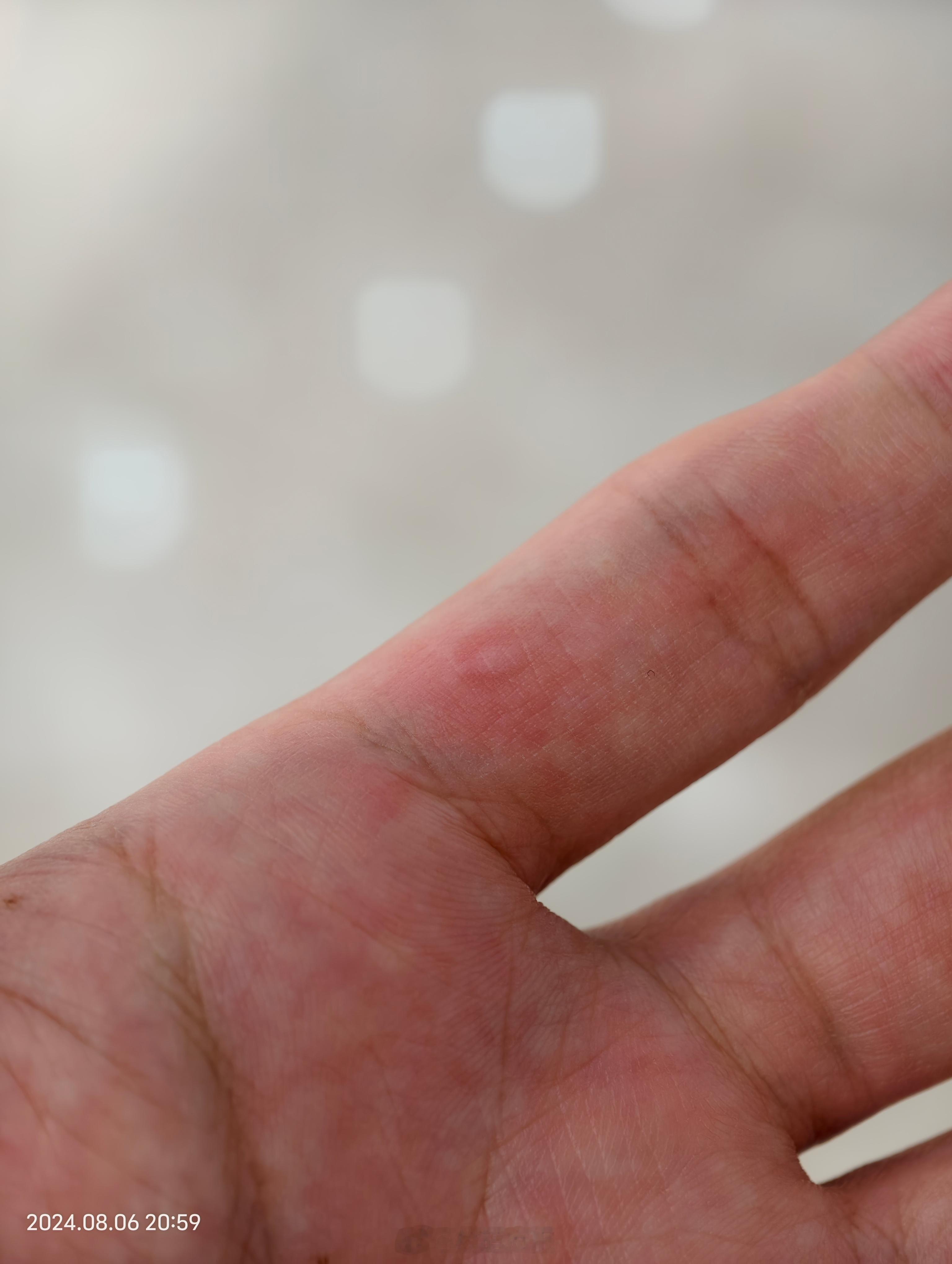 刚刚用某小折叠手机，单手合上的时候被夹了下手，还是挺疼的 ​​​
