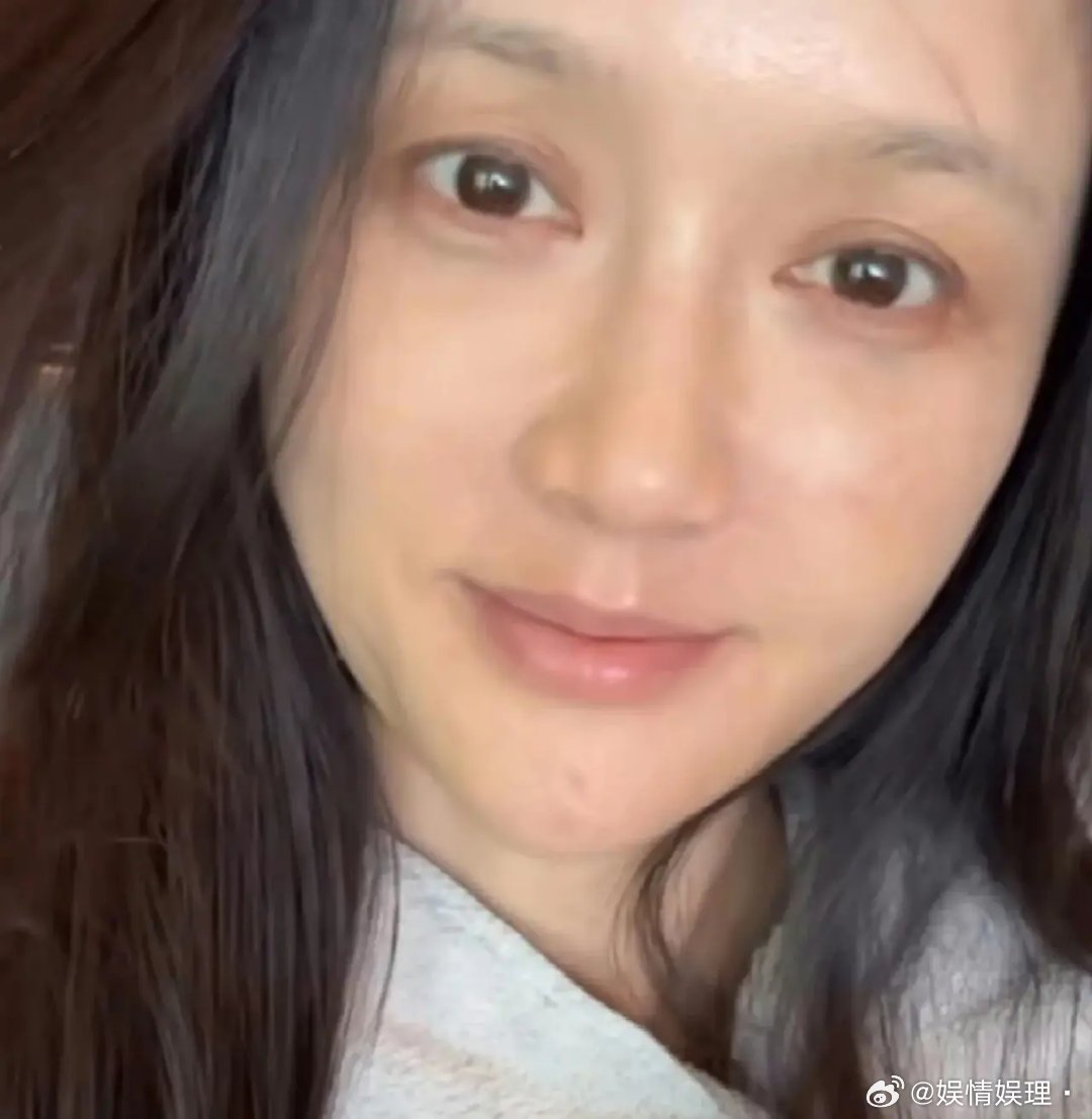 陈乔恩素颜引发热议！8月13日，陈乔恩突然晒出了自己的素颜照，照片里她脸色憔悴，