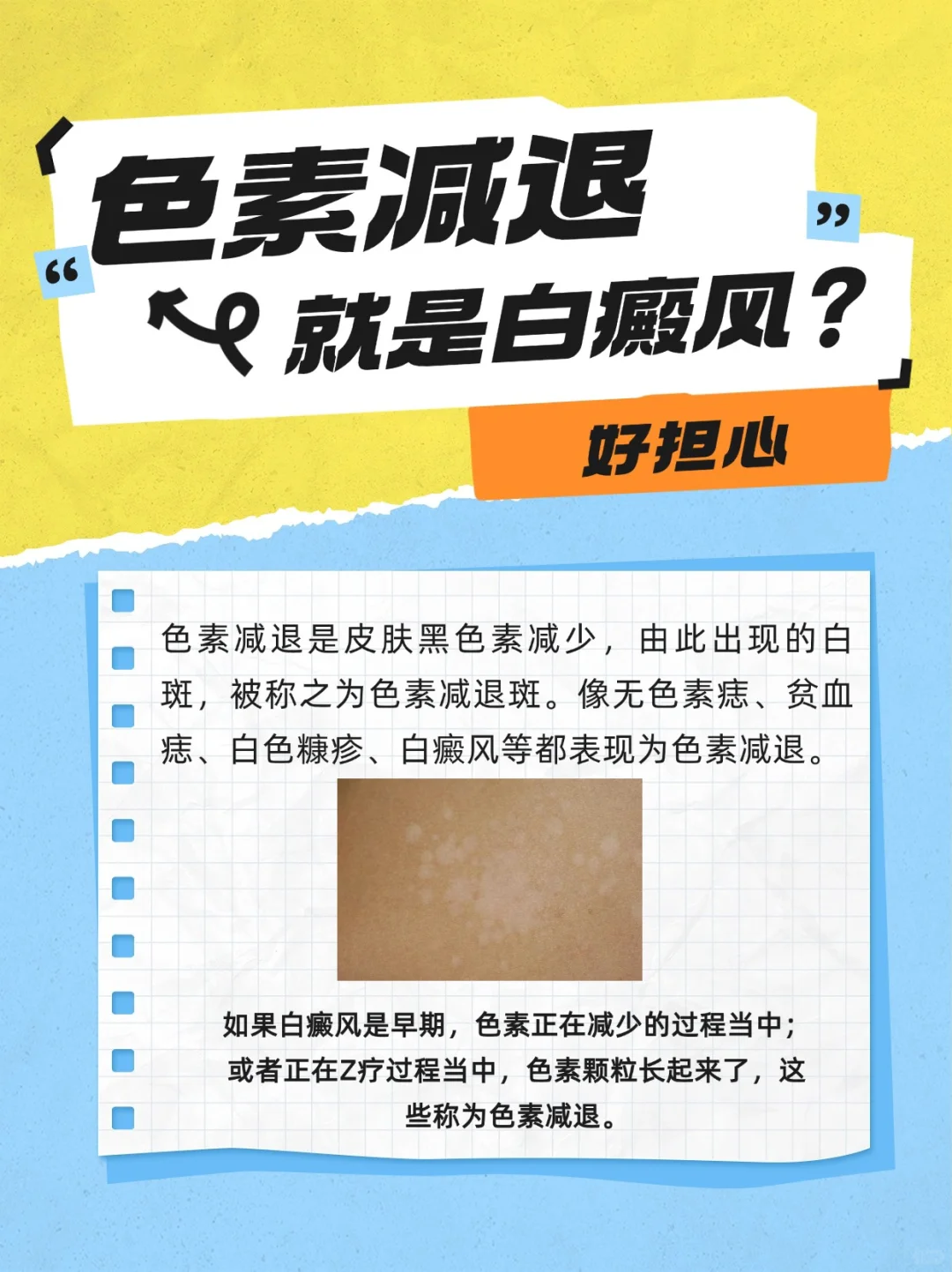 色素减退就是白癜风？担心白斑慢慢成白癜风