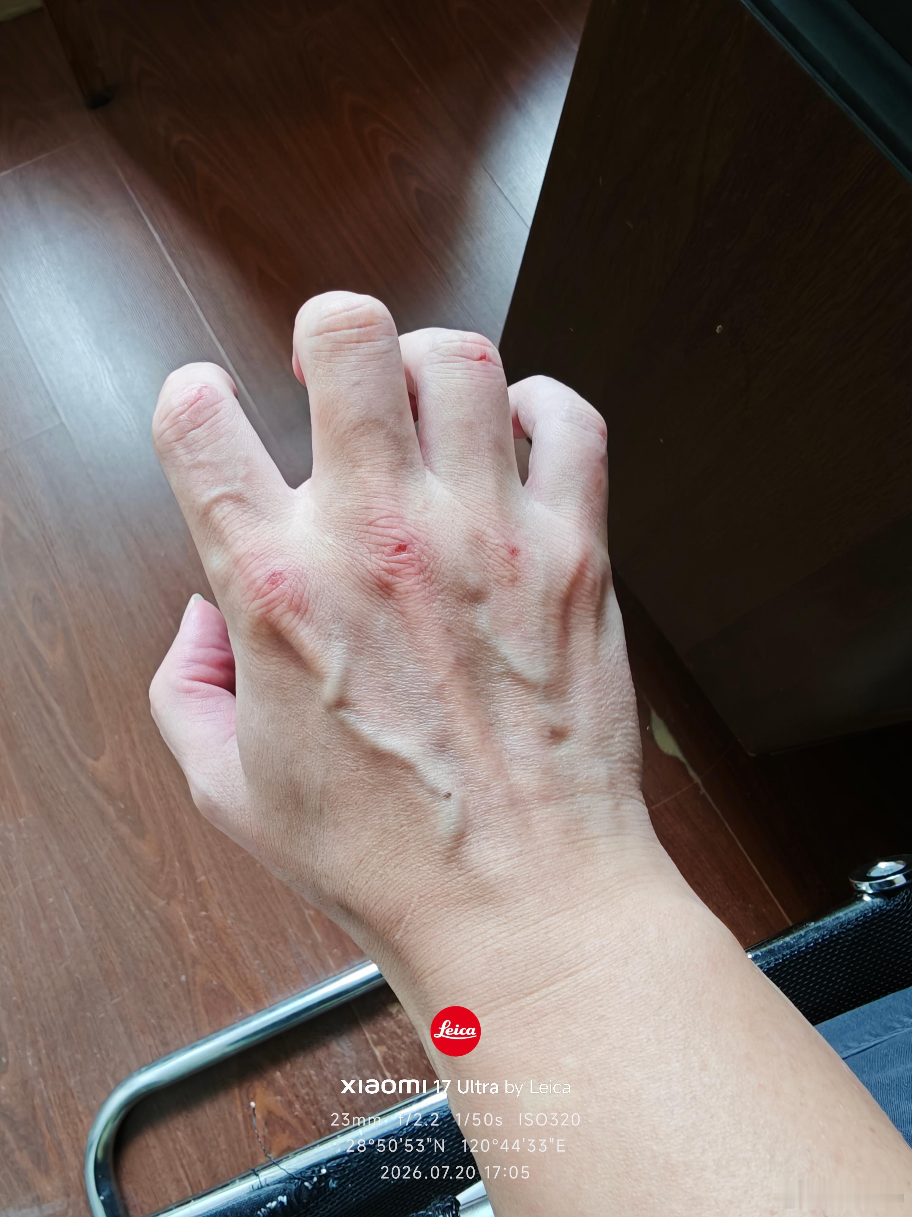 昨晚梦游去练拳击了？