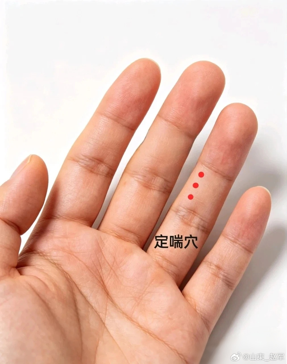 董氏奇穴·定喘穴完整授课讲义取穴口诀（便于背诵）定喘二穴无名指，第二节上桡侧寻。