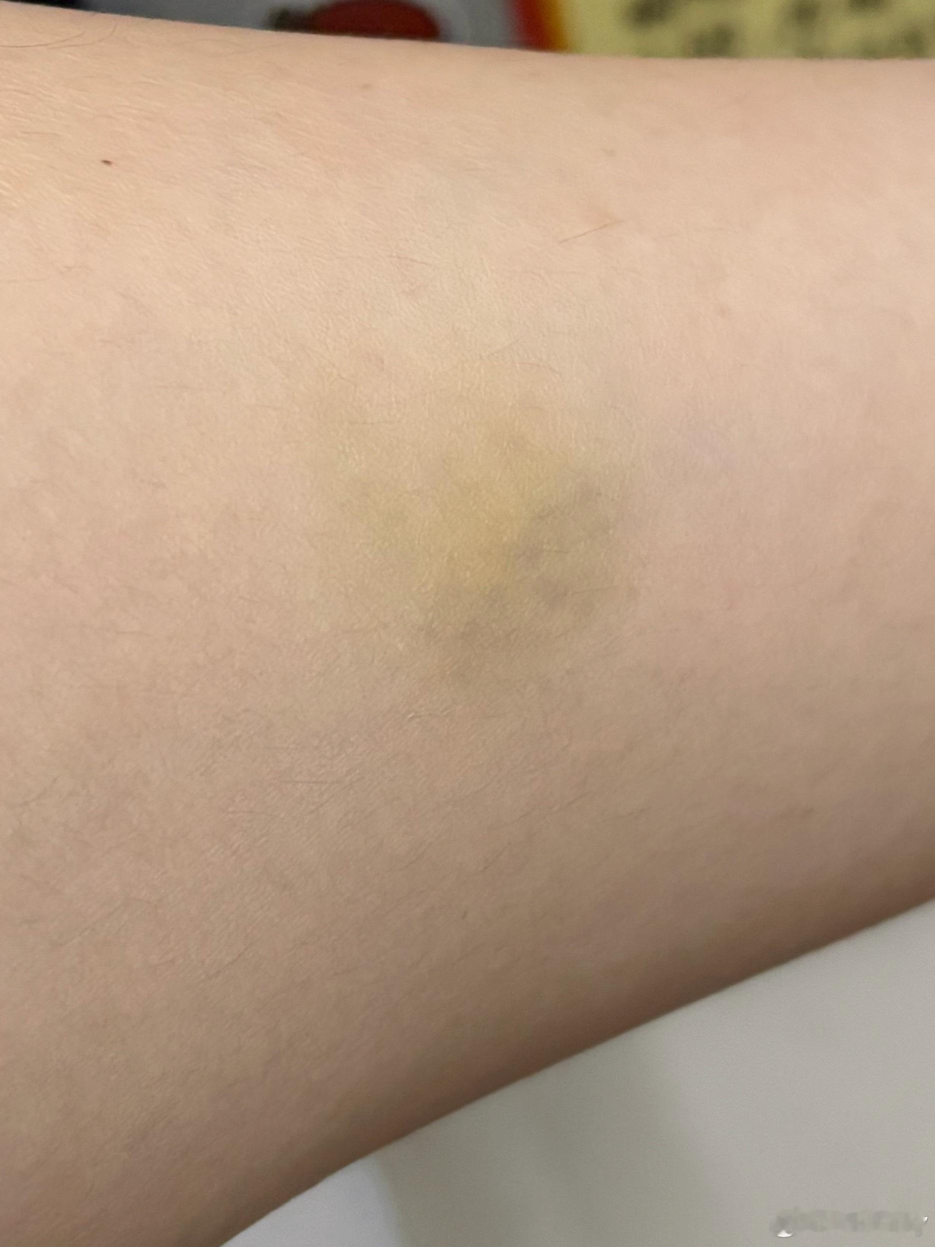 跳吧！我可怜的波棱盖 