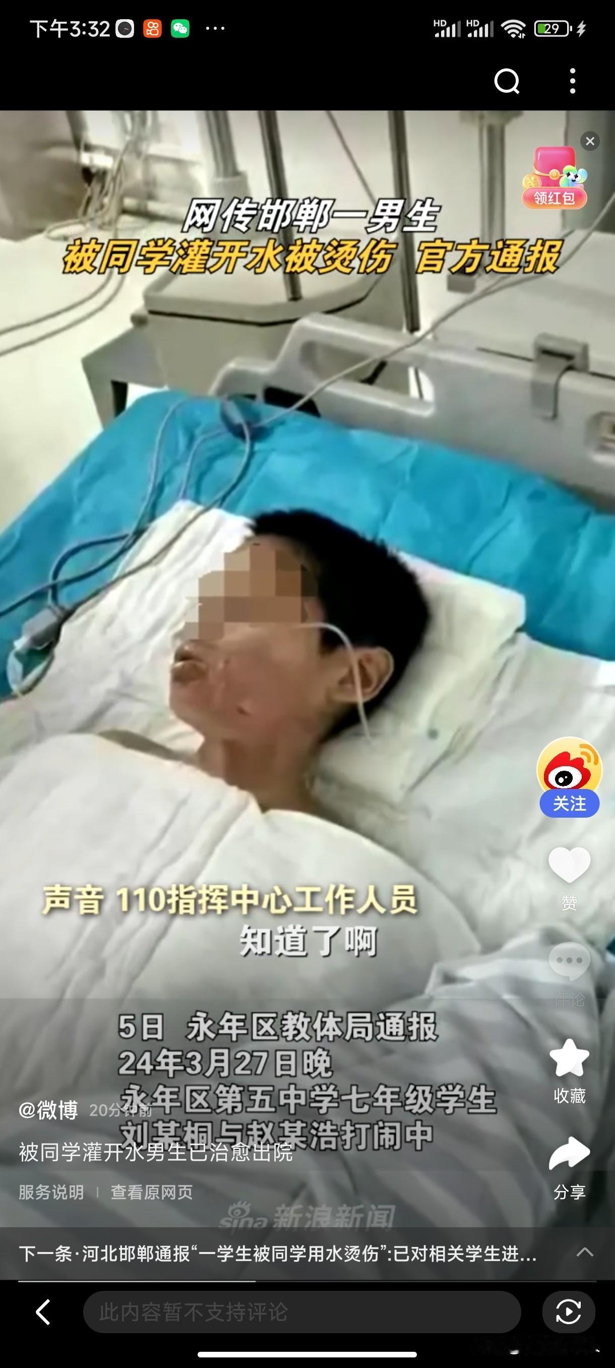 嘴巴被灌热水烫伤的孩子出院了！
2024年4月2日，网传河北邯郸一男孩遭到同学霸