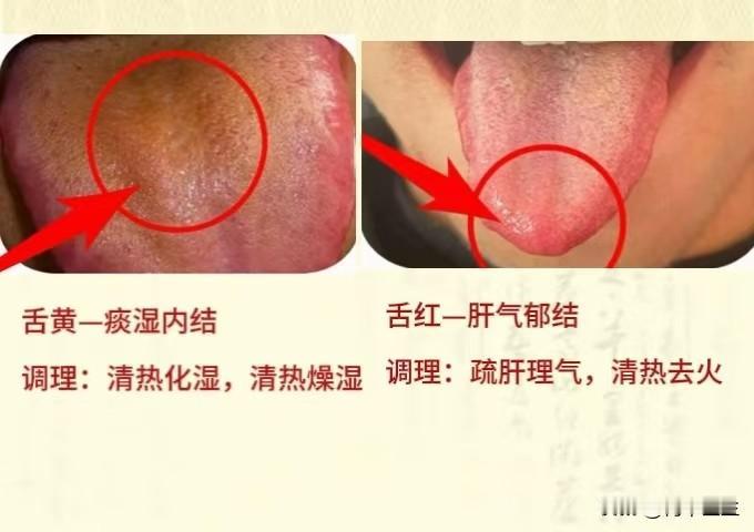 今天不太忙，继续帮粉丝看舌象，大家有什么问题都可以积极一点，你发我分析，全天在线