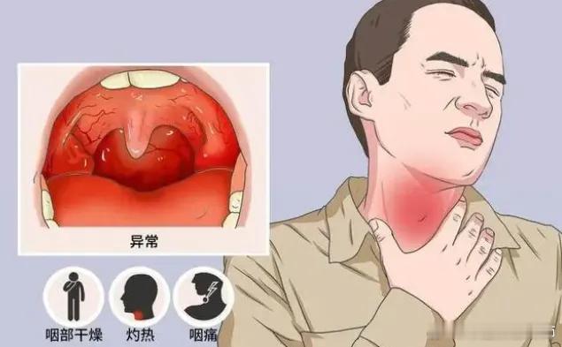 #清一清嗓 龙重登场##躲过新冠没躲过这次咽喉炎#教你简单方便缓解咽喉炎保护咽喉