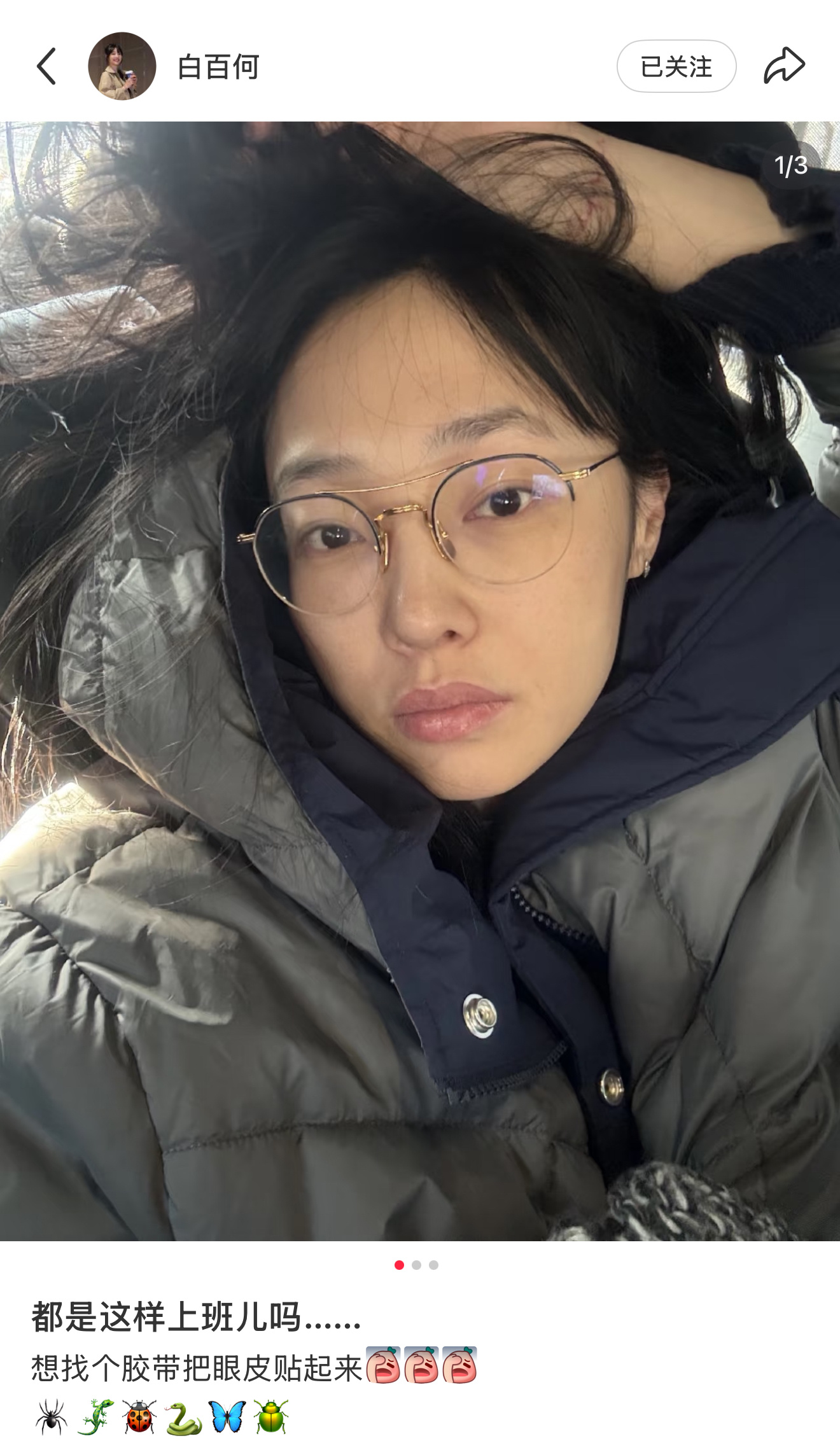 原来女明星上班也想用胶带把眼睛贴起来～ 