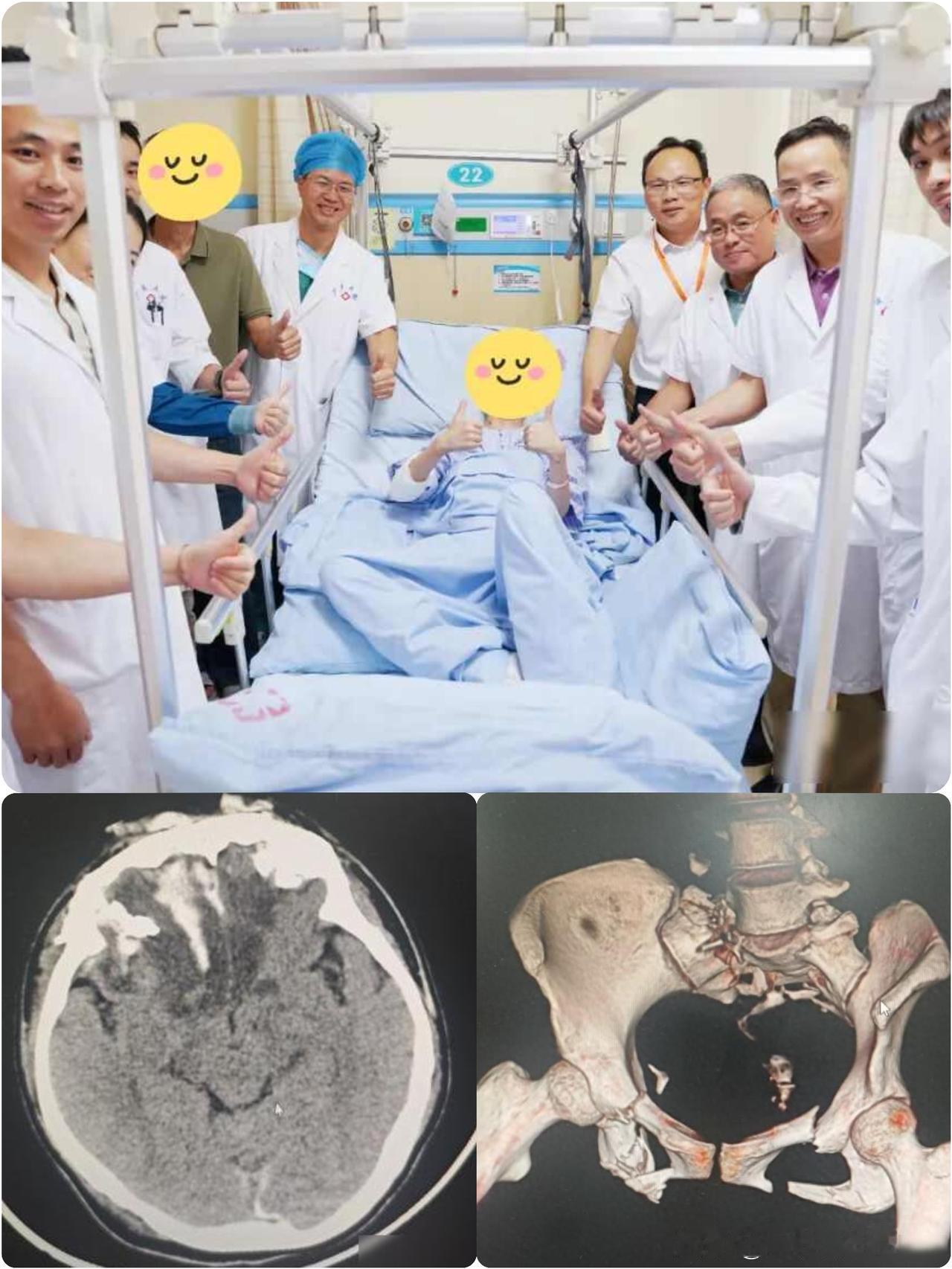 24岁女子晾晒衣服时不慎从6楼坠落，
全身粉碎性骨折、颅内大出血；
历经了千辛万