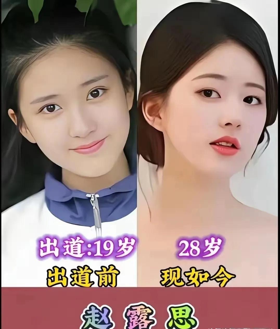 青涩旧照vs现在，你更喜欢谁的模样？
 都说女大十八变，看看几位的变化，美的有干