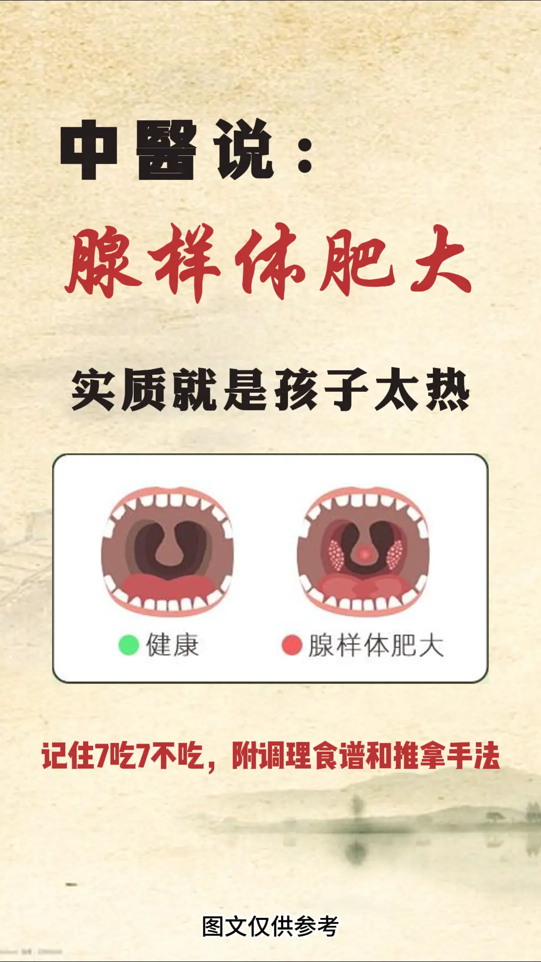 医学科普 育儿 家长必读 图文 腺样体肥大
