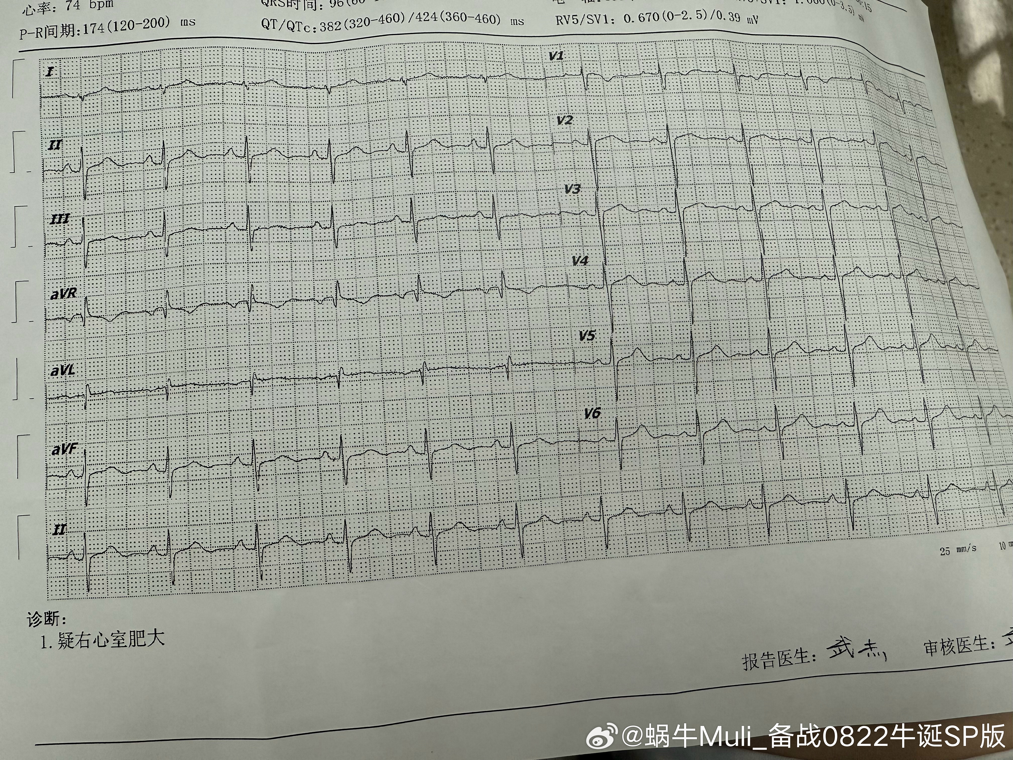 今天蜗蜗乖乖的和小北北一起去医院看医生了，结果见到医院里面的一楼居然有在卖咖啡，