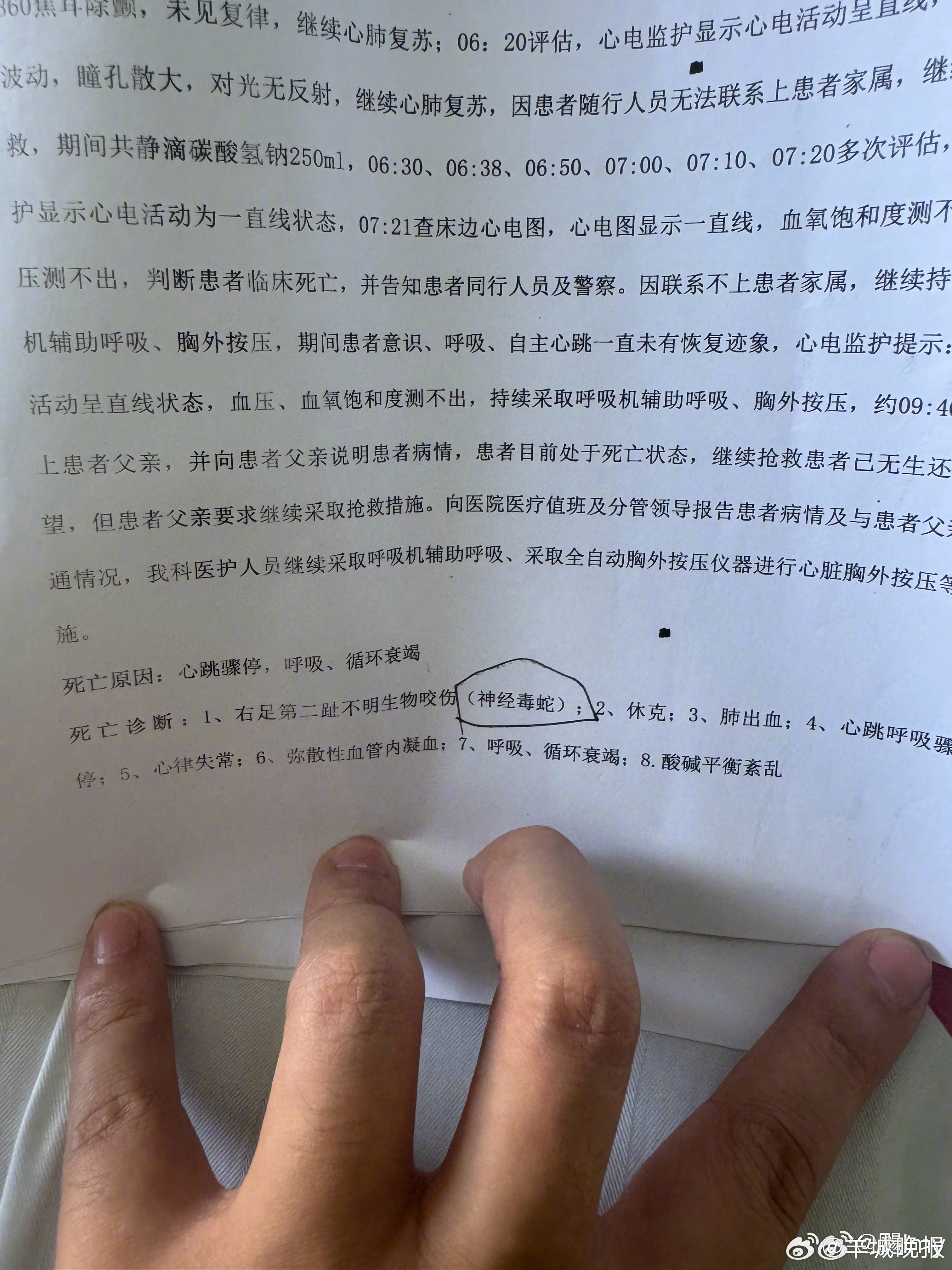 #三亚被咬身亡女子家属公开死亡诊断##女子右足第二趾为神经毒蛇咬伤# 近日，三亚