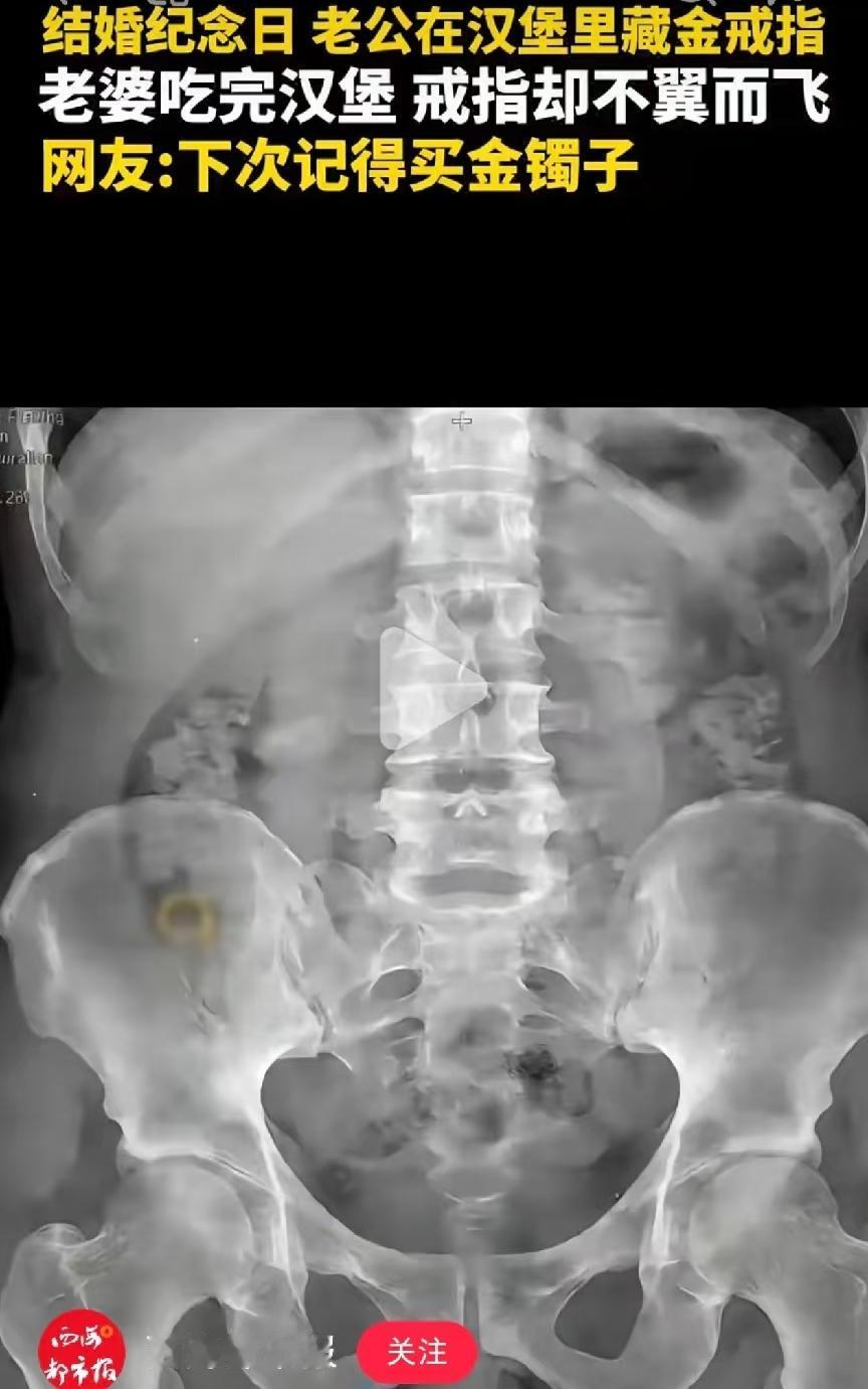 笑不活了！到了结婚纪念日，丈夫给老婆的汉堡里装着一枚金戒指！老婆吃完汉堡后，金戒