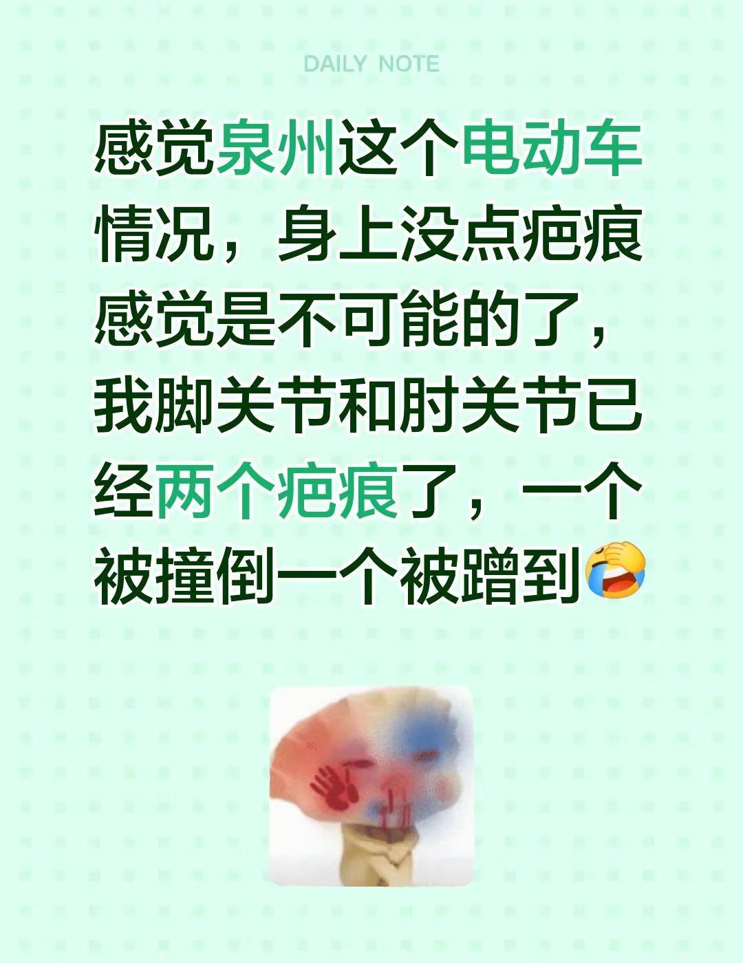 感觉泉州这个电动车情况，身上没点疤痕感觉是不可能的了，我脚关节和肘关节已经两个疤