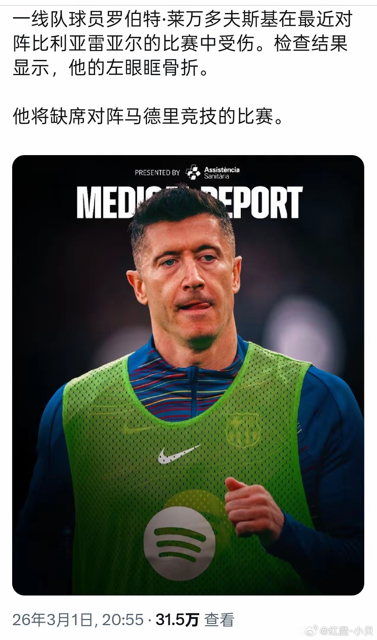 莱万在巴萨的日子进入倒计时，终究输给了岁月。本赛季14球1助攻，远不及上赛季的4