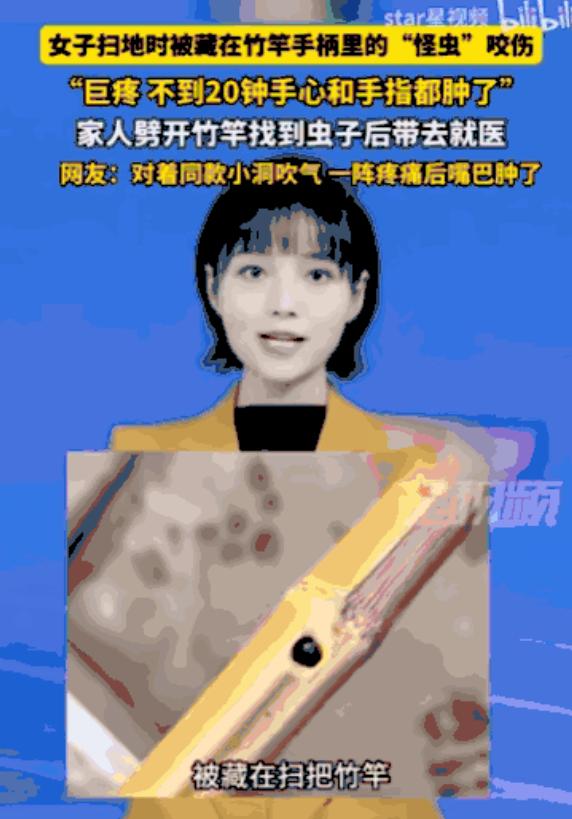 万万没想到！四川雅安，一位女子在家里扫地时，竟被扫把柄里窜出的一只“怪虫”狠狠咬