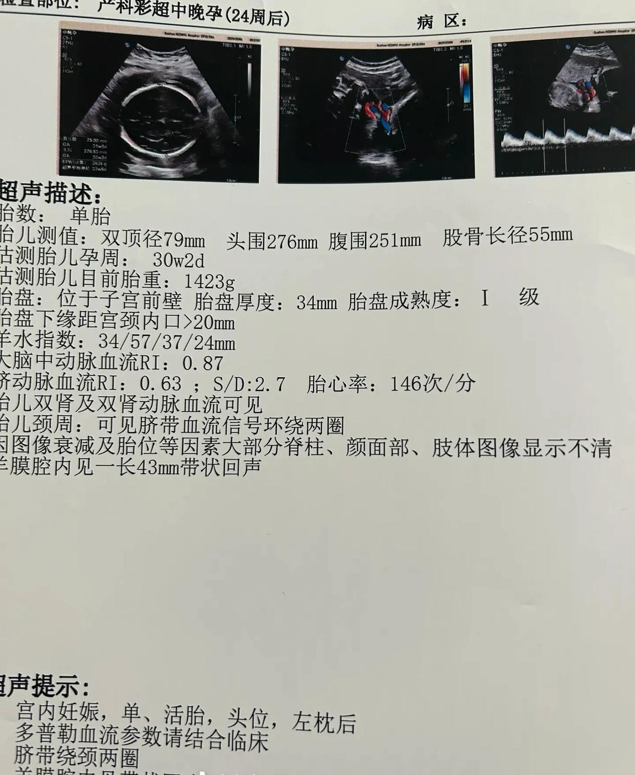 胖了24斤了，快来说说你们都胖了多少斤。