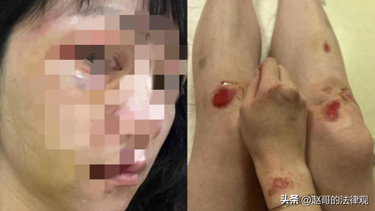 福建厦门，女子常年被丈夫家暴，被打的受不了就离家出走了，多年一直在外地漂泊流浪。