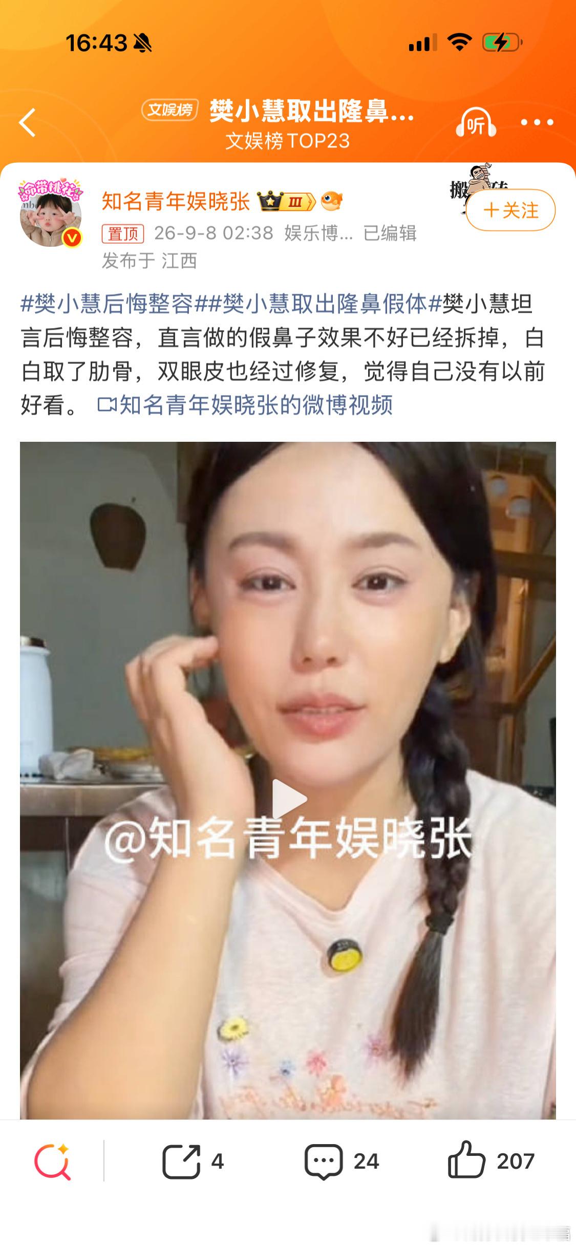 樊小慧取出隆鼻假体千万网红樊小慧直播官宣，已经取出肋软骨隆鼻假体，同时修复双眼皮