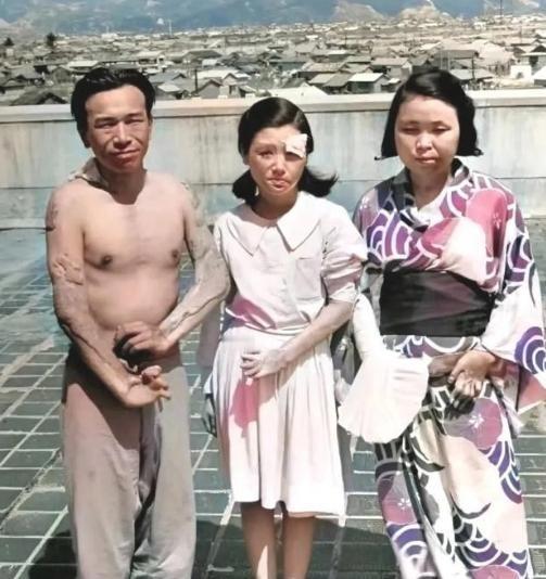 1945年，广岛原子弹爆炸后，三个幸存者，留下了这一张照片，镜头中的他们眼神非常