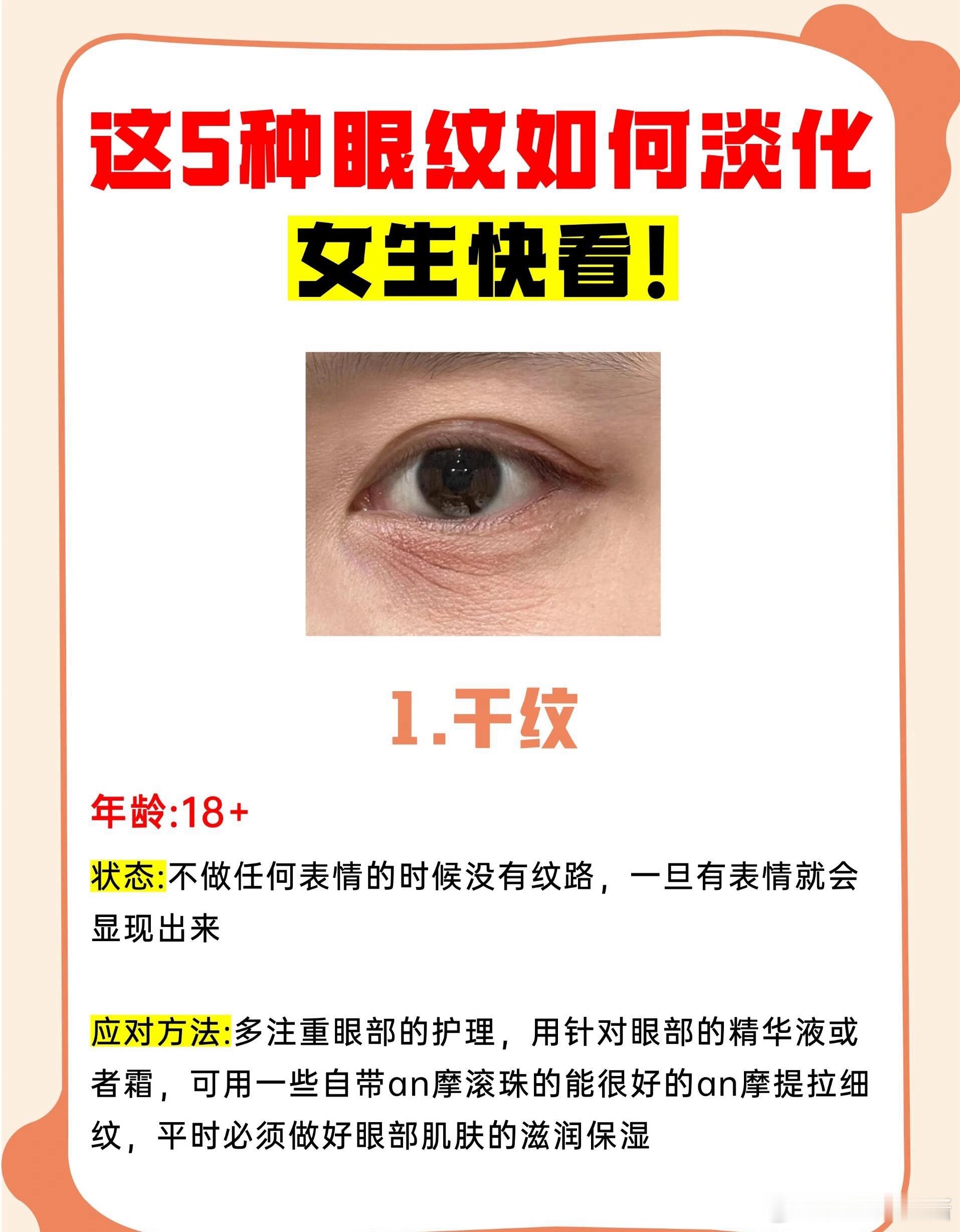 护肤分享功效护肤 5种眼部皱纹最怕这样做❗（快看你是哪种）5种眼纹如何淡化女生必