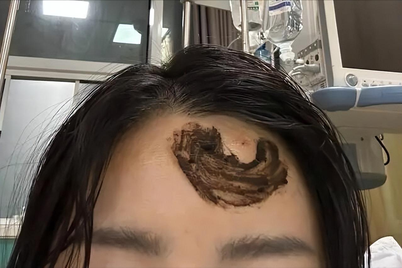 谁能想到，免费逛太阳山森林公园，会让任女士一家 4 人遭遇马蜂突袭？原本惬意的爬