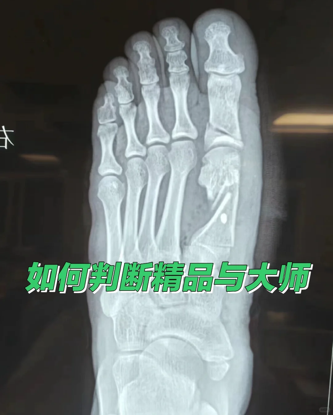 如何判断顶级病例及顶级专家